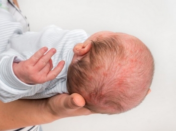 Allergieën bij kinderen : Symptomen, oorzaken en behandeling 